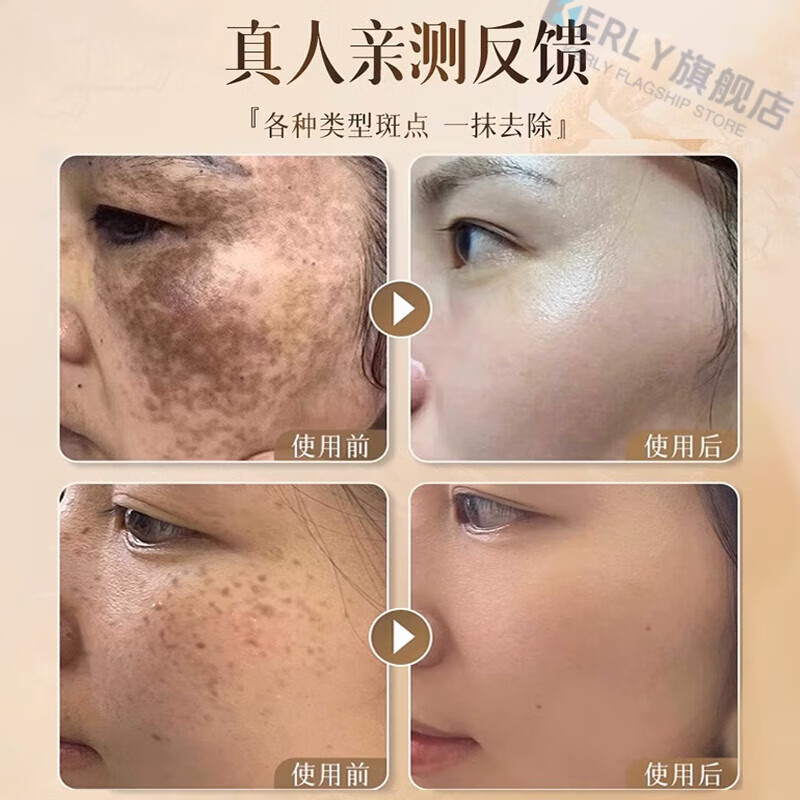 KERLY薇诗澜祛斑面霜去黄提亮肤色净瑕美白修护淡化色斑美白正品 【体验装】1瓶装 官方直售