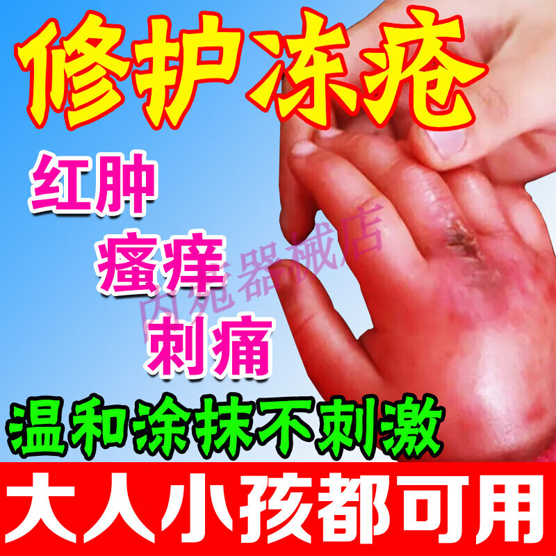 绿蓓健 冻疮膏 成人儿童治手脚皮肤脸部耳部瘙痒根红肿冻伤防裂专用