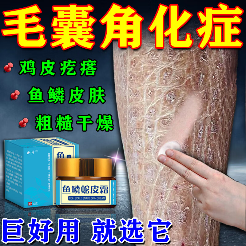北京同仁堂去鸡皮肤疙瘩毛囊角化症专用液体敷料儿童成人毛囊角质疙瘩