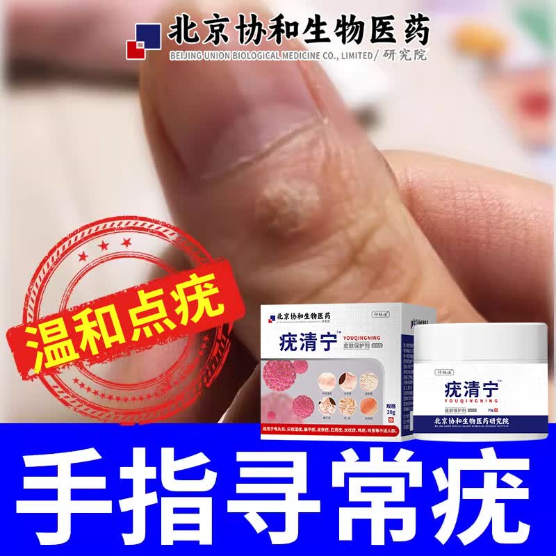 【大药房直发】ftkh寻常疣专用膏辅助手指上长的寻常疣刺瘊子可搭