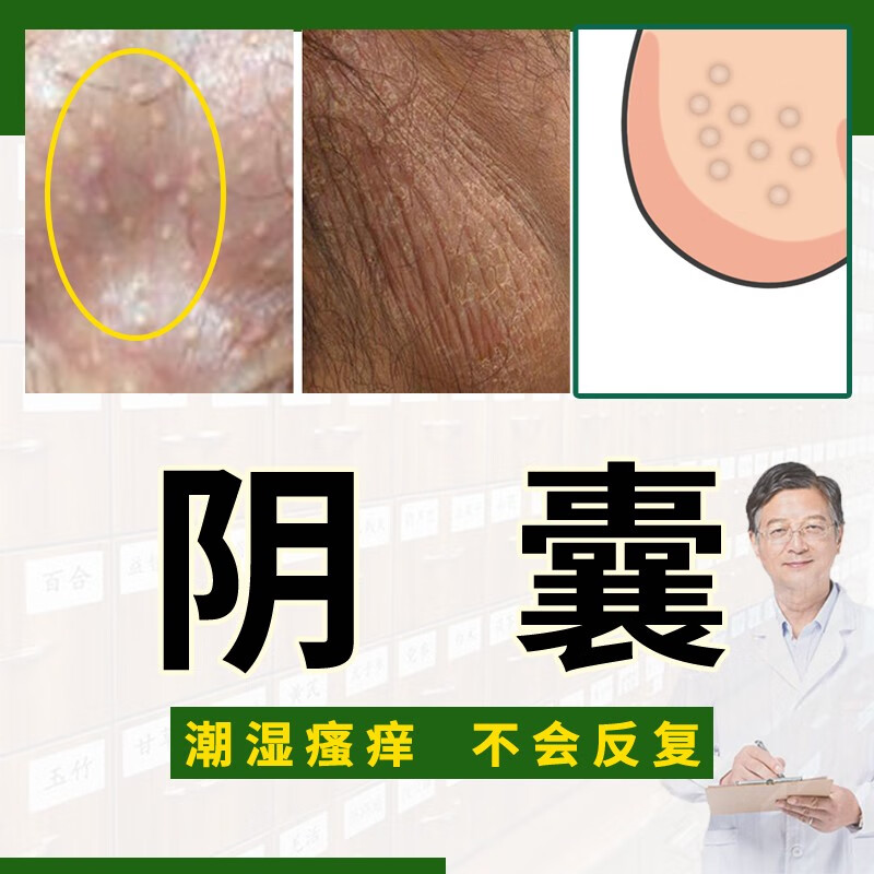 白斑净十大品牌排行榜