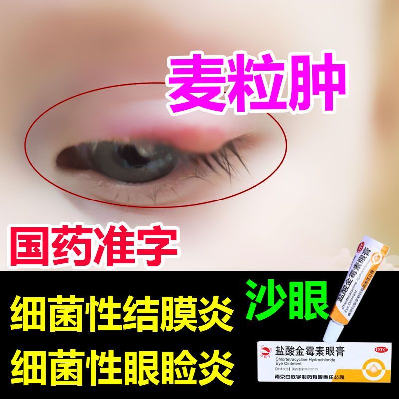 5%*2g 沙眼眼睛干涩细菌性结膜炎 麦粒肿药膏 眼睛肿痛发炎眼睑炎分泌