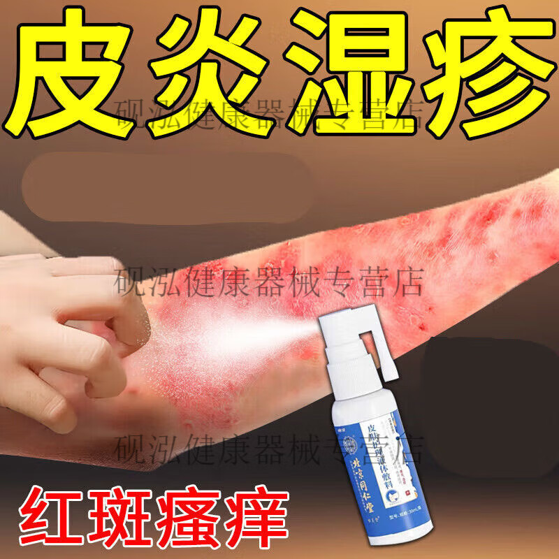 皮肤皮湿疹真菌感染喷剂 改善皮湿疹引起的皮肤干燥脱屑红斑症状 1