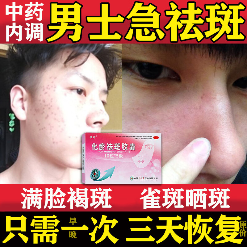 祛斑点斑专用药水  化瘀祛斑胶囊 1盒装【脸上常年斑】