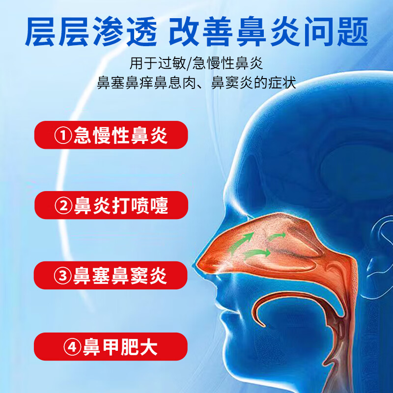 呼必安红外鼻敏贴鼻炎鼻贴特效急慢性鼻炎过敏性鼻炎儿童可用鼻塞流涕 5盒 【巩固装】长期顽固鼻炎适用