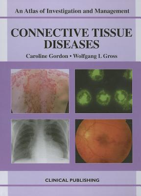 预订connective tissue disorders: an atlas of investi