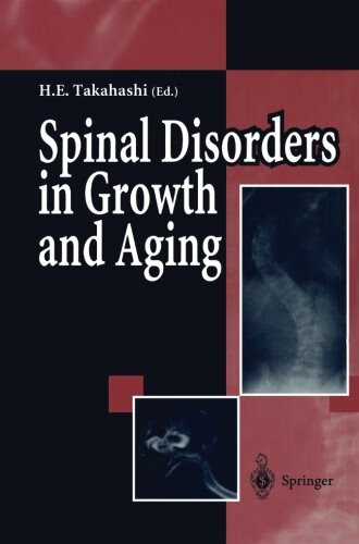 预订 spinal disorders in growth and aging