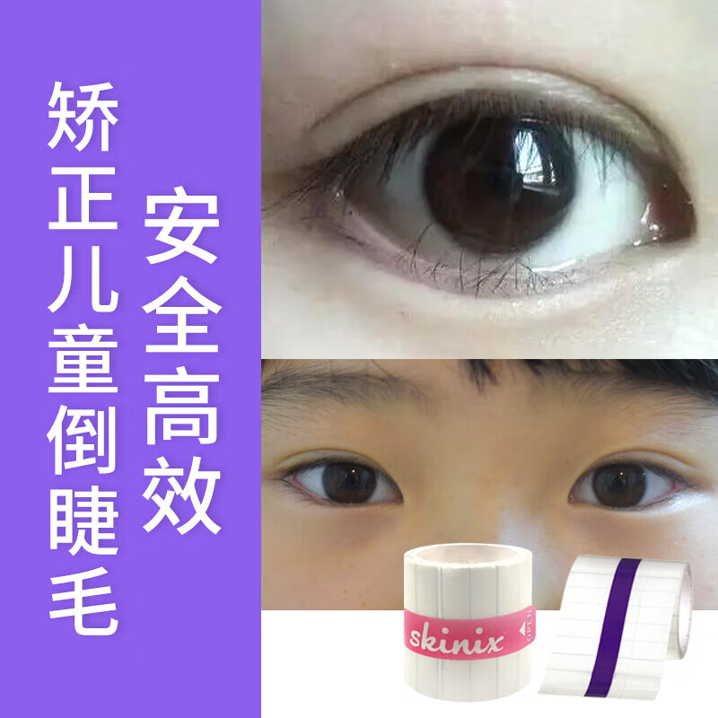 儿童倒睫毛贴小孩儿童倒睫毛胶带提拉眼皮松弛倒睫胶布 25mm*3m