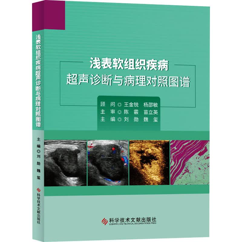 浅表软组织疾病超声诊断与病理对照图谱 图书