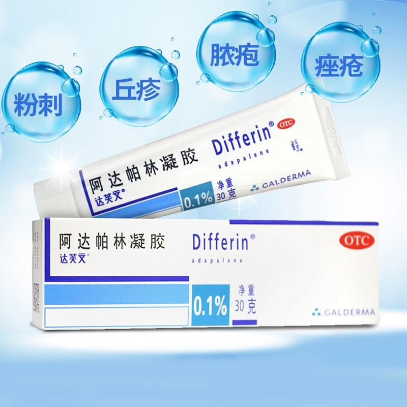 进口去闭口粉刺祛痘膏痤疮丘疹脓包可用与脸部胸部后背的痤疮治疗vs