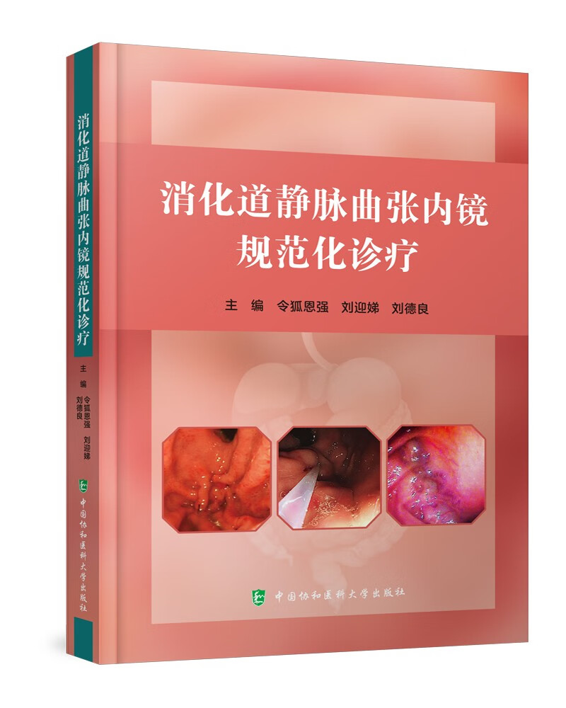 消化道静脉曲张内镜规范化诊疗