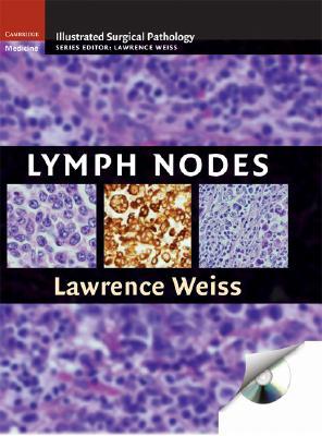 预订lymph nodes [with cdrom]