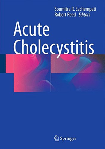 预订 acute cholecystitis