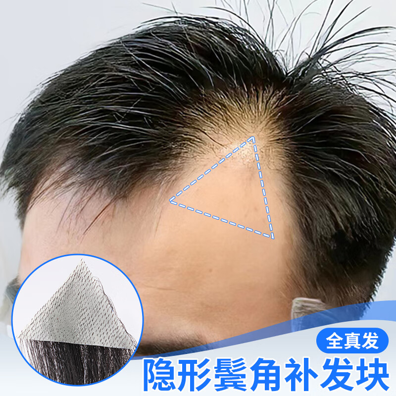 哈韩姑娘男士假刘海片鬓角补发假发片男女全真人发m型前额发际线假发