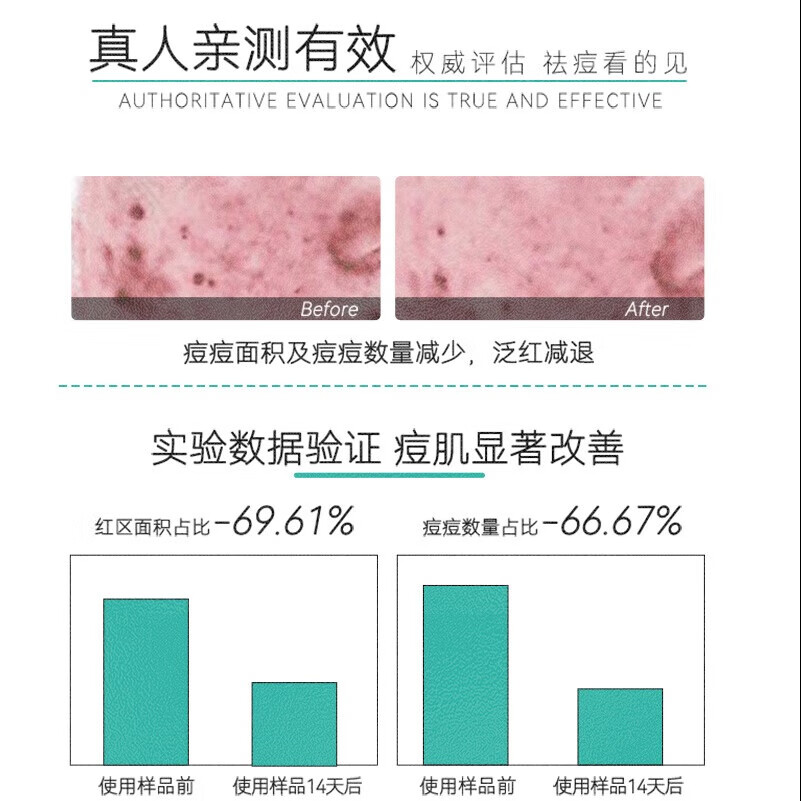 珀瓷PORCV壬二酸祛痘凝胶乳膏精华液药膏去痘净肤膏去黑头粉刺痘印去青春豆 祛痘舒缓凝胶25g×两支装