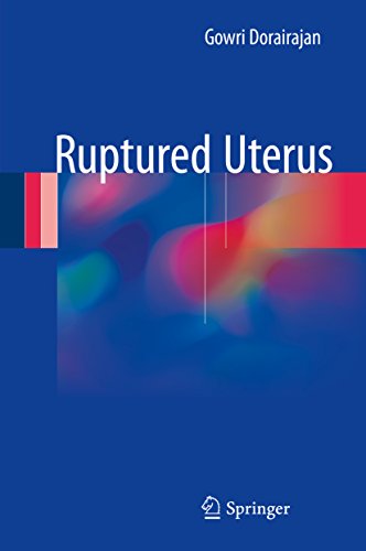 预订 ruptured uterus