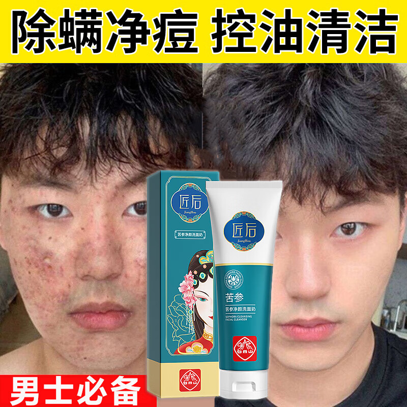 白云山祛痘洗面奶控油清爽黑头痘印收缩毛孔深层清洁男女通用200g