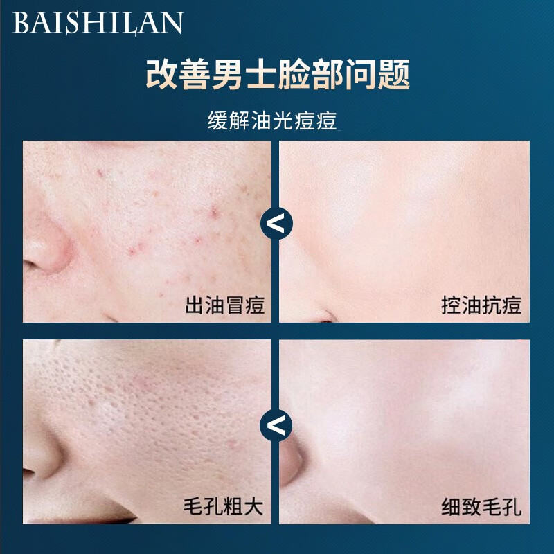 佰仕兰(baishilan)男士专用洗面奶护肤品套装控油祛痘黑头补水保湿氨基酸男生洁面乳 面霜【保湿滋润】