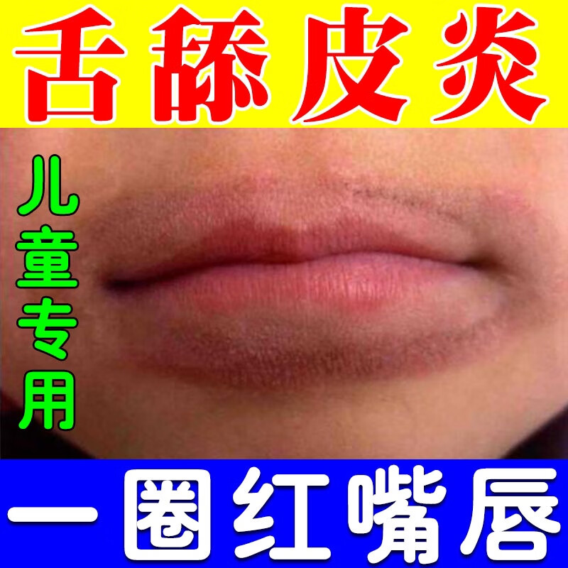 云南本草唇炎唇膏嘴唇干裂脱皮唇周炎防起泡起皮烂嘴角软膏 20g_一