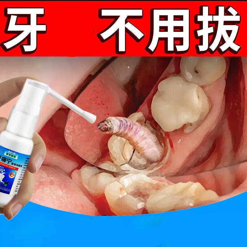 澳德力康止l痛速去牙l疼上火牙l痛宁喷剂蛀虫牙龈肿痛消l炎牙神经痛 买3+2【五盒巩固装】