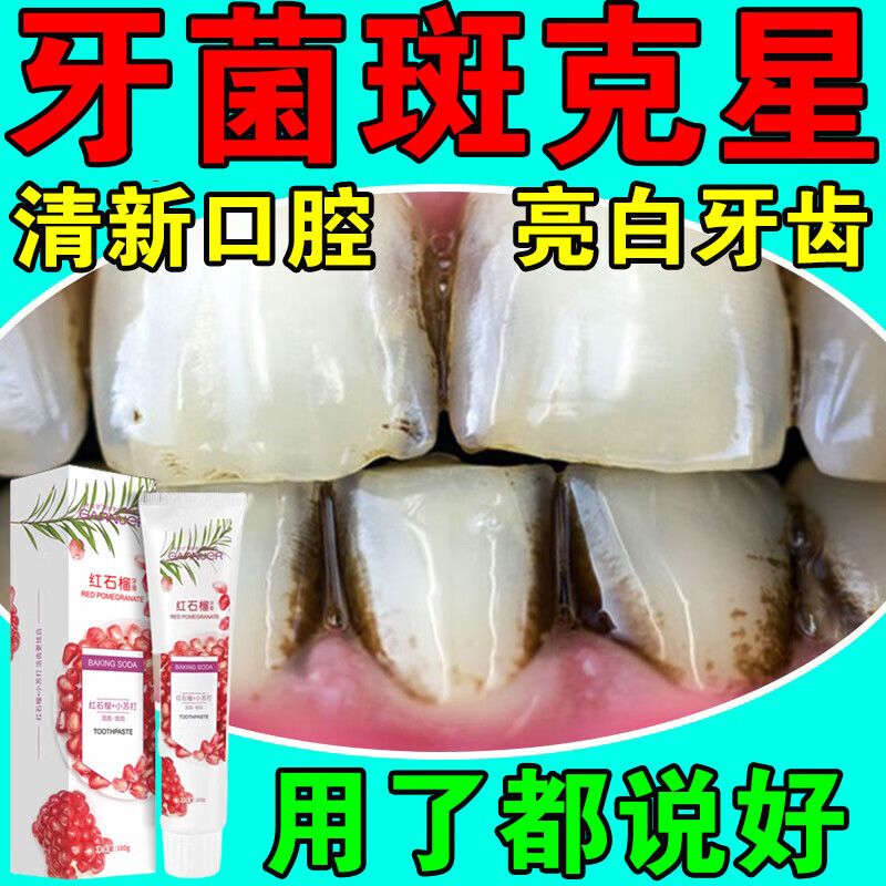 【官方直售】去牙菌斑牙膏去牙渍黄牙黑牙口腔菌斑去除神器防蛀牙儿童