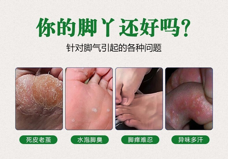 拜耳(bayer)窝状角质松解症脚丫脚臭糜型脚底蜂窝状沙虫脚膏可搭 联苯