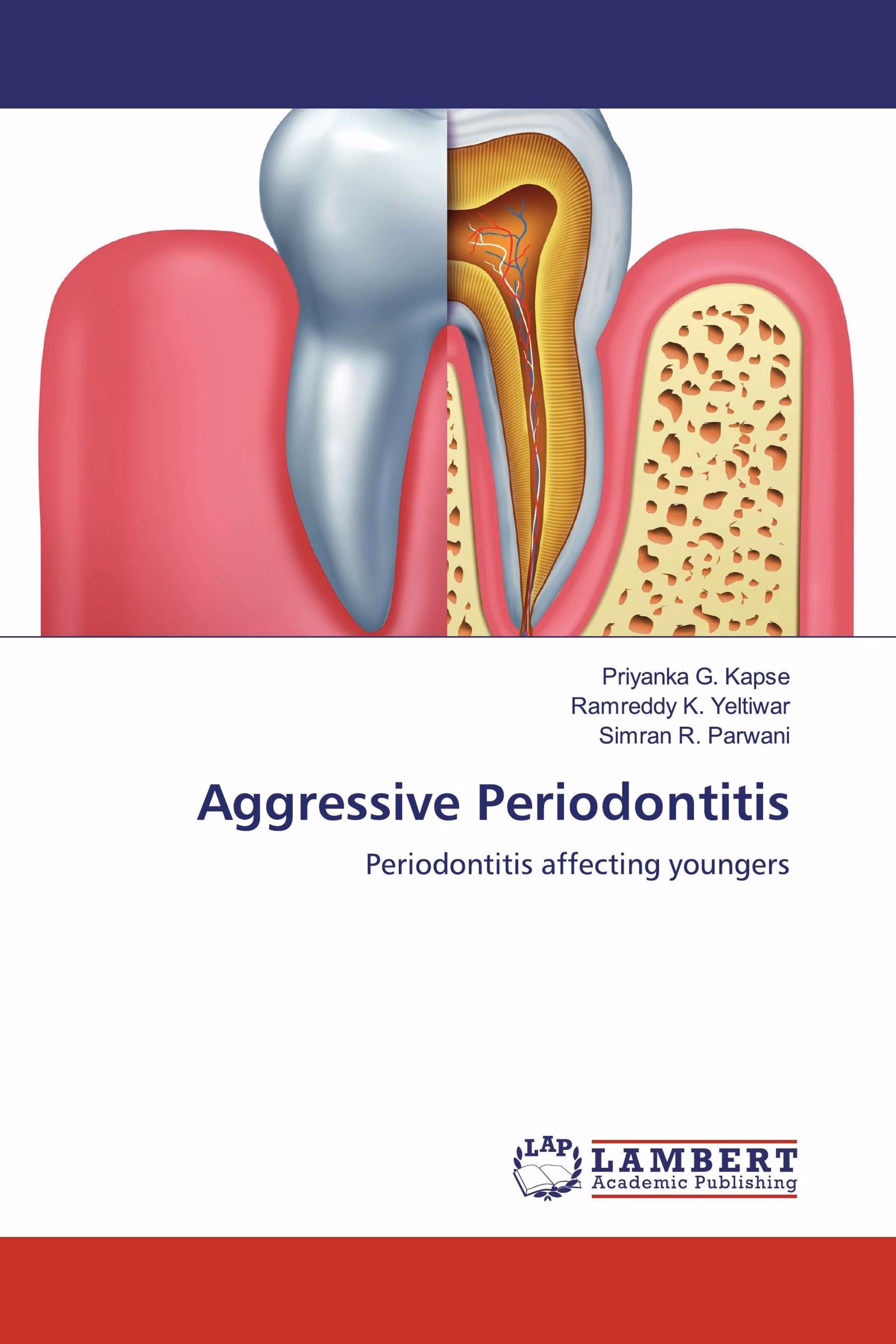 预订Aggressive Periodontitis