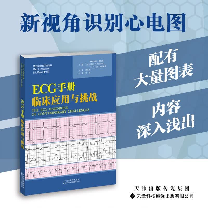 【出版社直发】ECG手册：临床应用与挑战怎么样,好用不?
