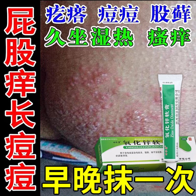 坐板疮药膏 久坐长疙瘩屁股湿疹长痘红疙瘩脓包痘疖子疮热痒屁股痒