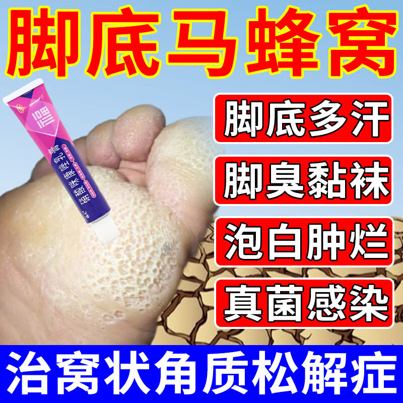 治脚气脚出汗脚底蜂窝状药膏 窝状角质松解症脚底发白蜂窝脚臭脚脱皮