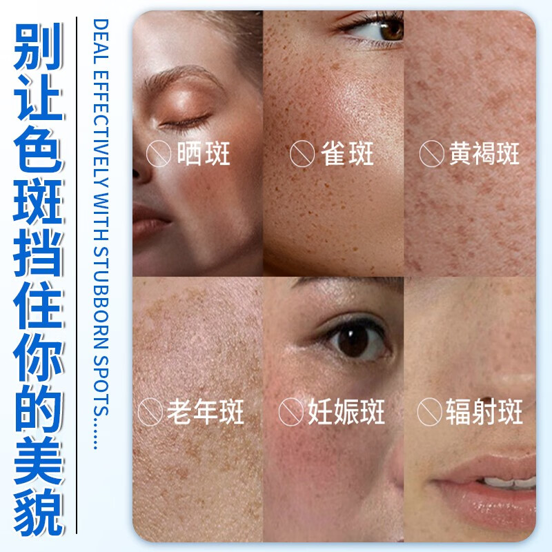 雪多妍美白祛斑精华液淡化黑色素去雀斑老年斑黄褐斑烟酰胺改善搭祛斑霜 一盒精华液【建议多盒装】