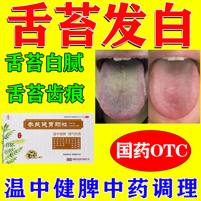 舌苔发白口干口苦口臭脾胃虚弱湿气大肝火旺大便不成形舌苔发白吃什么