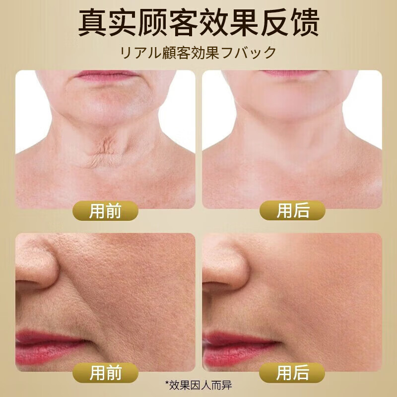 焦博士玻尿酸原液精华液抗皱紧致精华淡化细纹提拉紧致视黄醇次抛精华