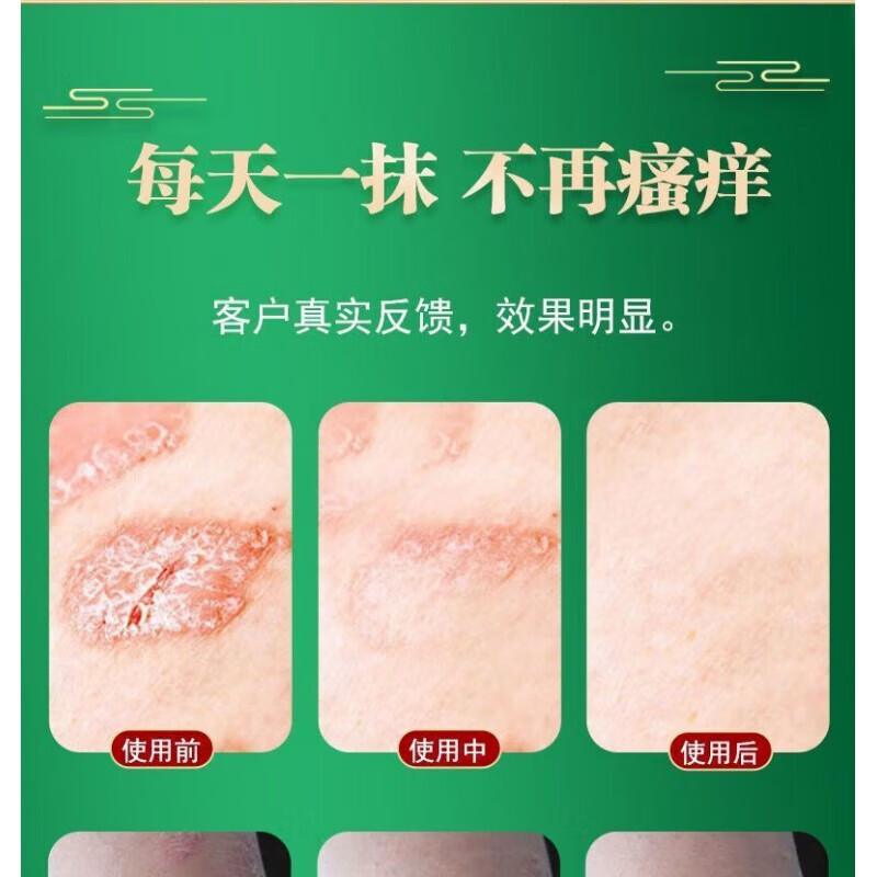 HKCQCQ元旦白鲜膏白鲜皮膏牛皮鲜膏白鲜皮膏缇田（TIT 三盒