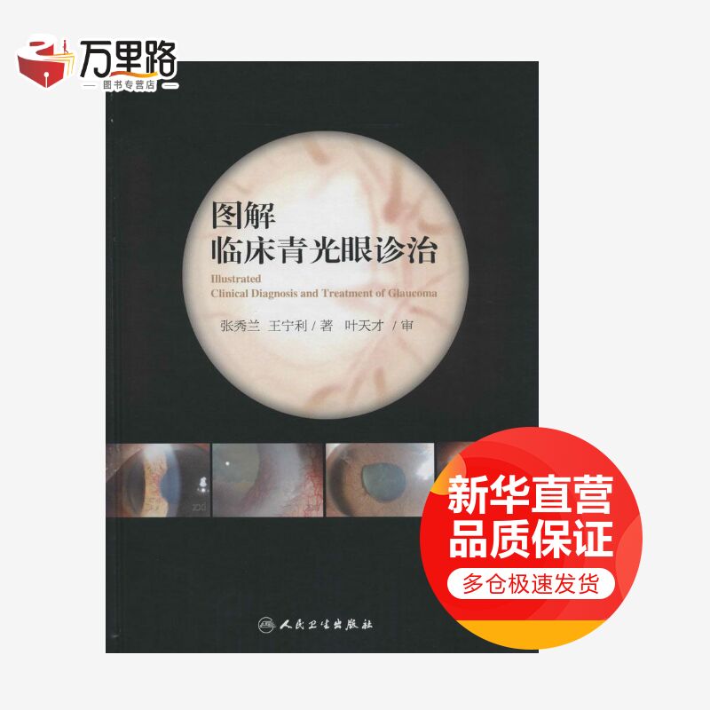 图解临床青光眼诊治