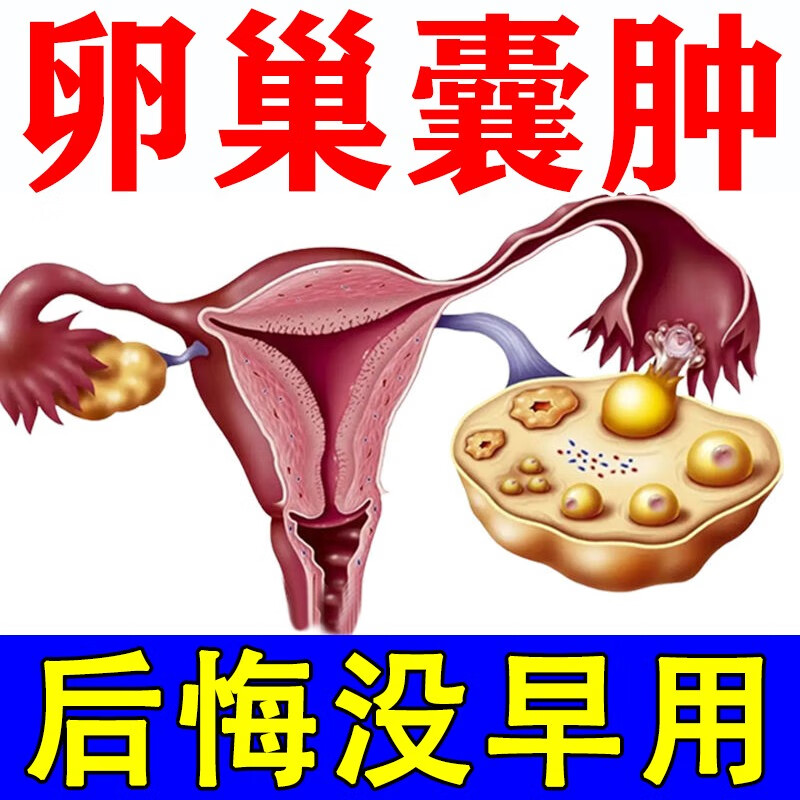 卵巢囊肿调理中药贴调理备孕保养腺肌症巧克力囊肿积水积液小腹痛 单