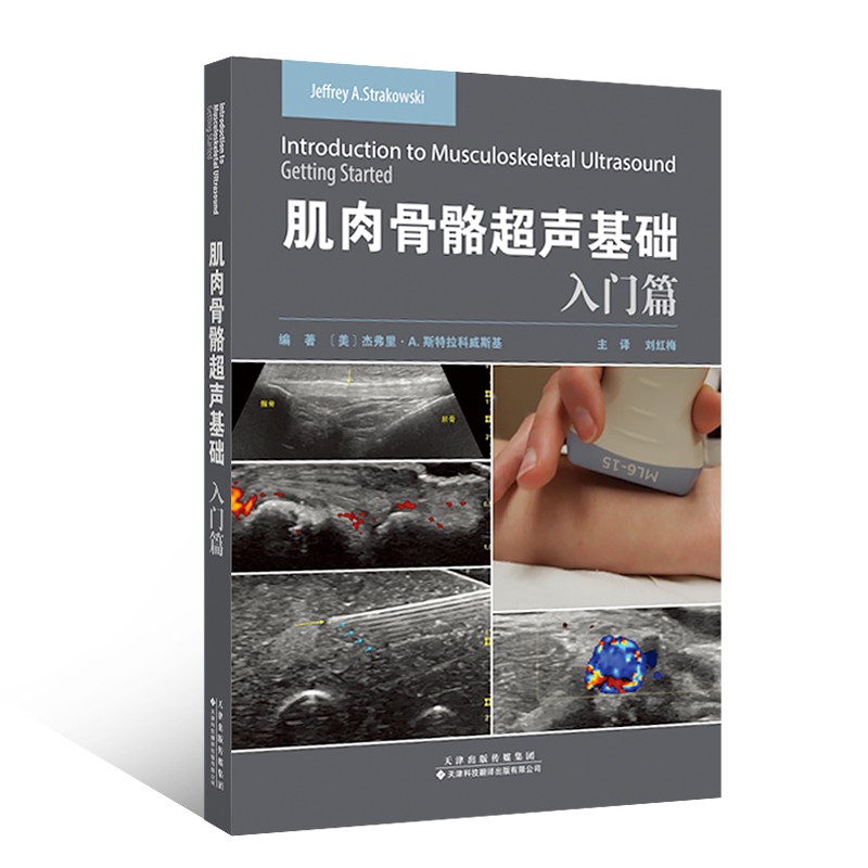 肌肉骨骼超声基础：入门篇