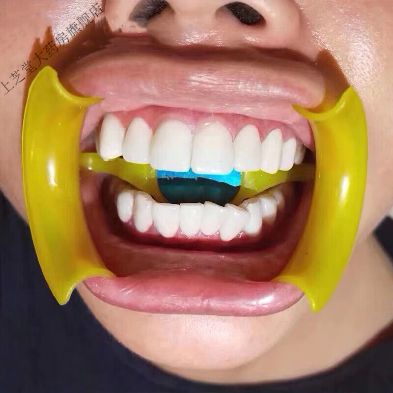 牙科m型带镜开口器 口撑张口器c型透明扩口器 蓝色牙齿撑嘴器 m型黄色