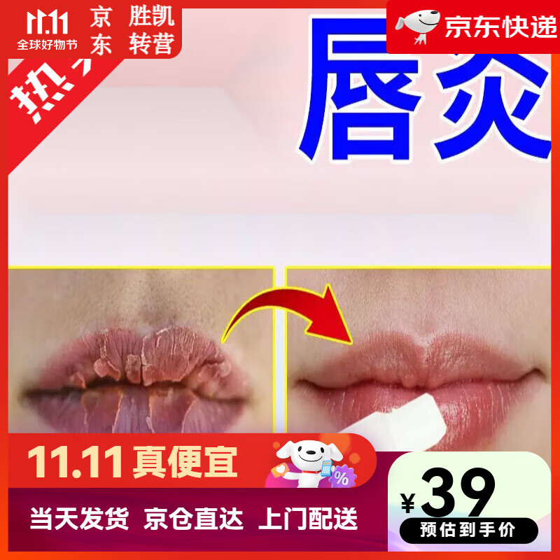 唇炎唇膏  适用于唇炎嘴唇干裂脱皮溃烂起泡出血唇炎膏 单盒体验
