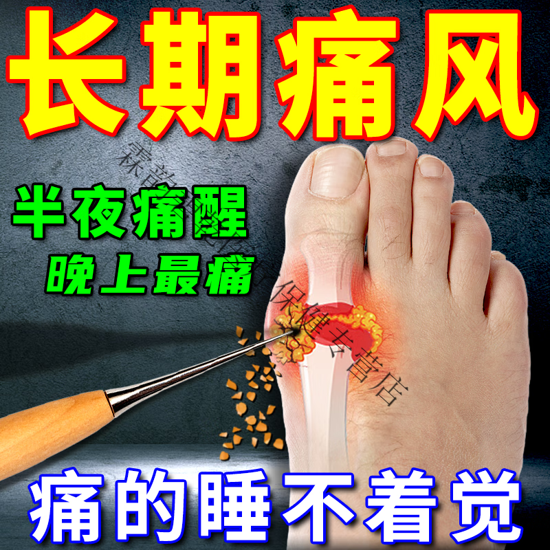 痛风敷凝胶大脚趾关节红肿疼痛关节变形活动受限半夜痛醒痛风贴结 1瓶