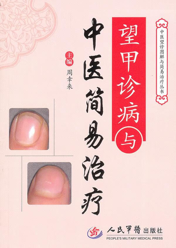 望甲诊病与中医简易治疗