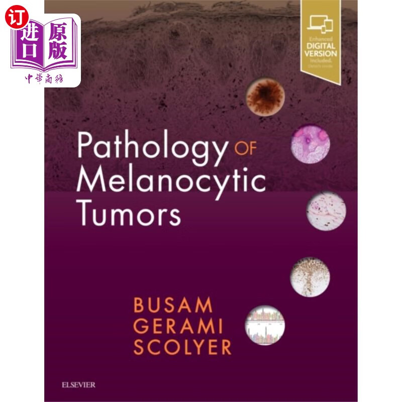 海外直订医药图书pathology of melanocytic tumors 黑素细胞肿瘤的