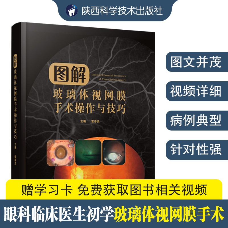 图解玻璃体视网膜手术操作与技巧