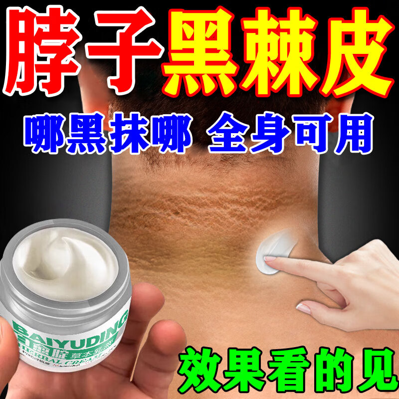 病膏治脖子黑色素去除胖人黑脖子代谢紊乱黑棘皮症淡化色素沉淀药乳膏