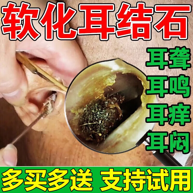 修正软化耳屎的滴耳液儿童耳结石软化水耳耵聍清洗液快速清理耳朵耳痛