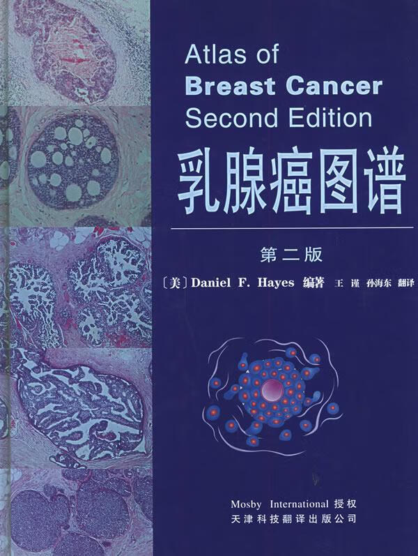 乳腺癌图谱【正版图书】