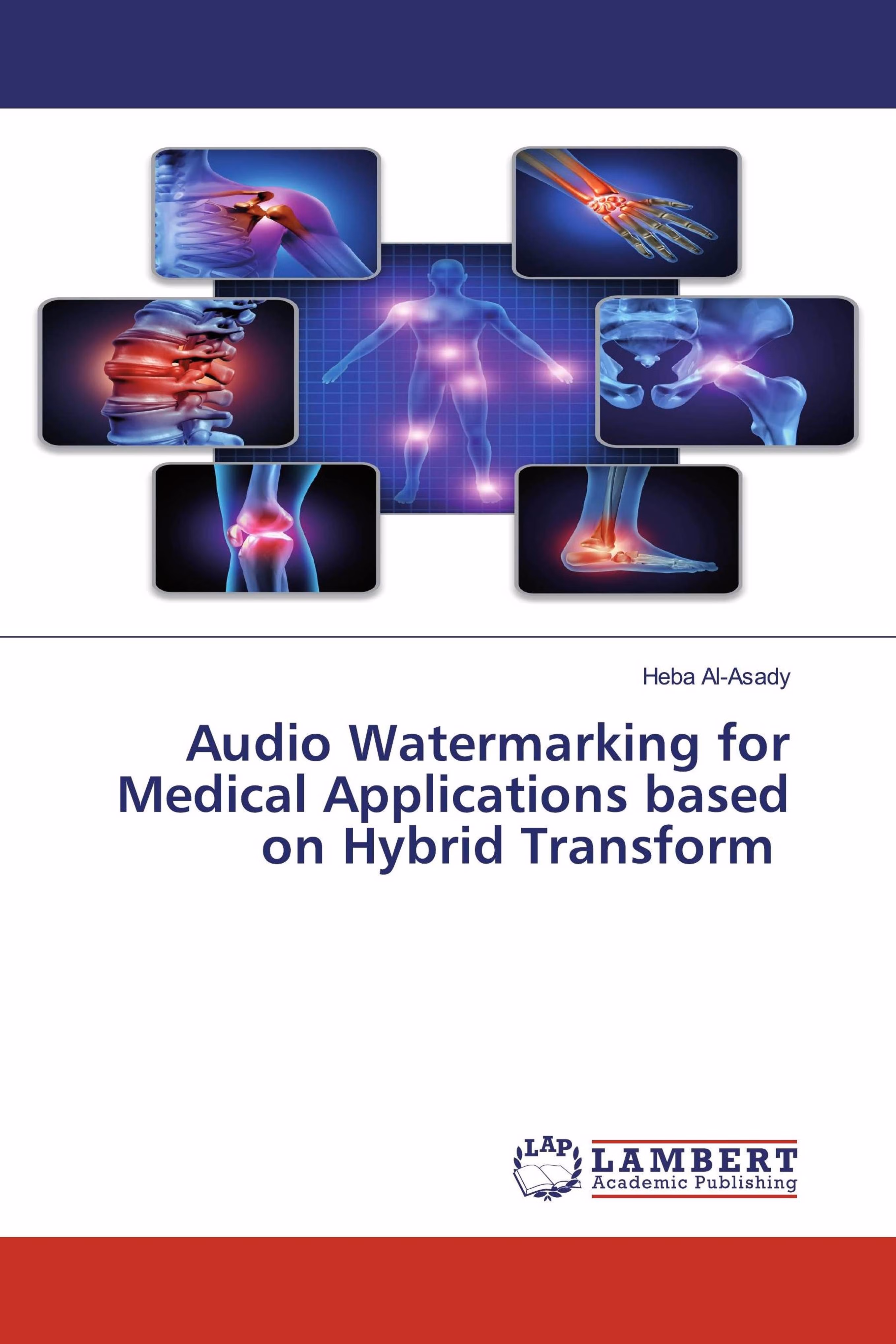 预订Audio Watermarking for Medical Applications base
