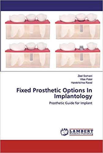 预订Fixed Prosthetic Options In Implantology