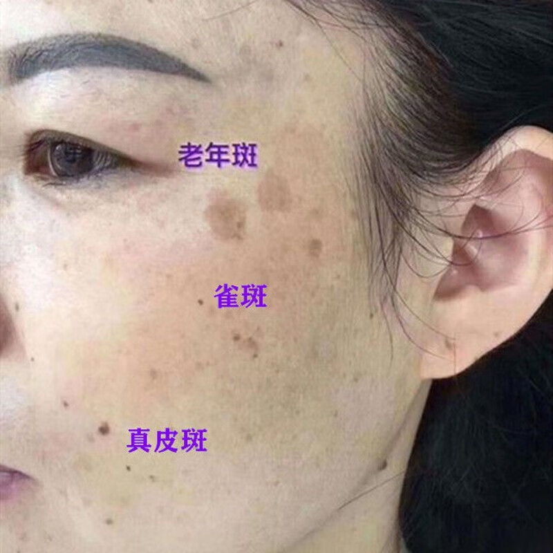 NHFOUYOU美白祛斑面膜补水保湿去黄提亮肤色女补水紧致抗皱日出倾城面膜 1盒【30ml*5片】建议按疗程购买