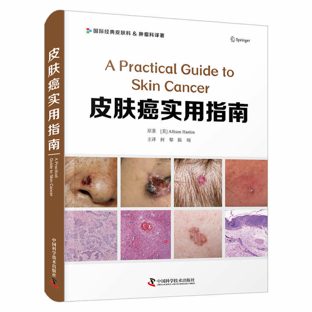 皮肤癌实用指南